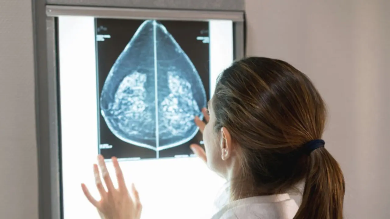 Reggio Calabria, al Gom open day della Breast Unit: visite gratuite e informazioni sulle patologie del seno