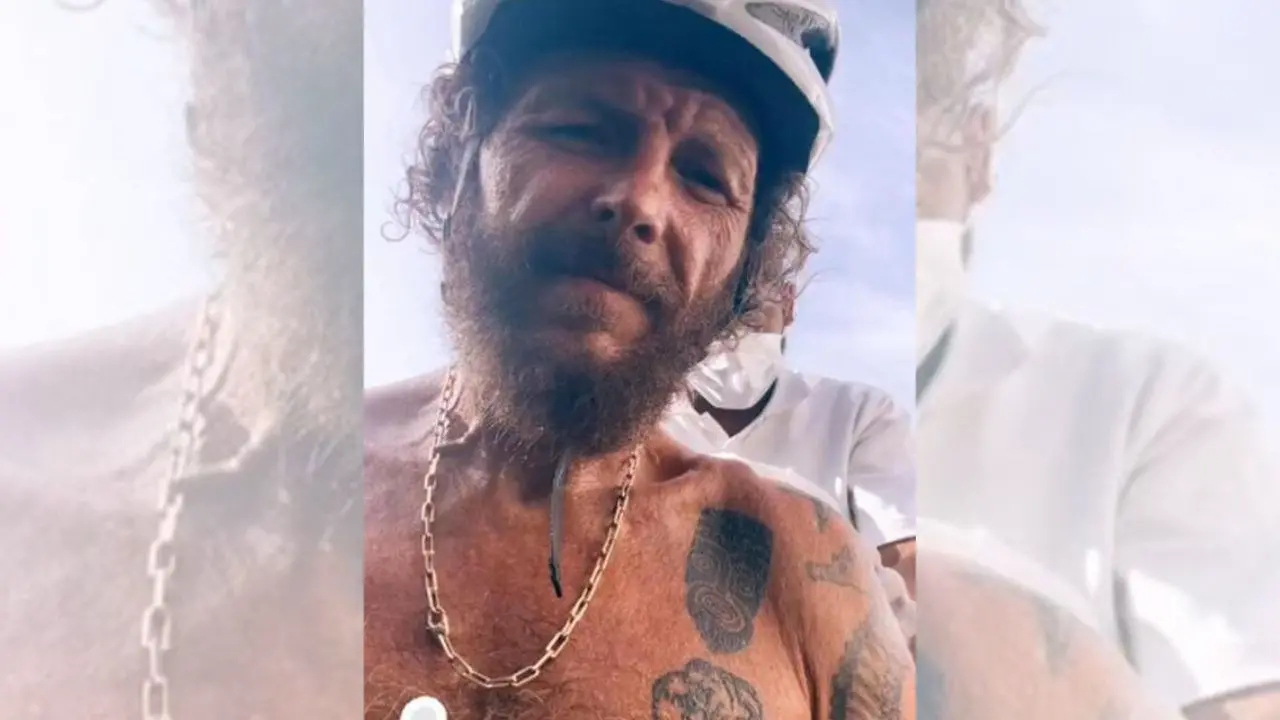 Jovanotti, brutta caduta in bici a Santo Domingo: femore e clavicola rotti