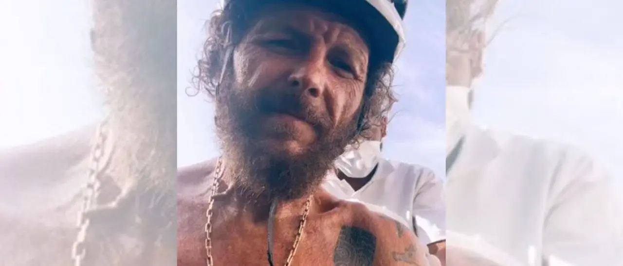 Jovanotti, brutta caduta in bici a Santo Domingo: femore e clavicola rotti