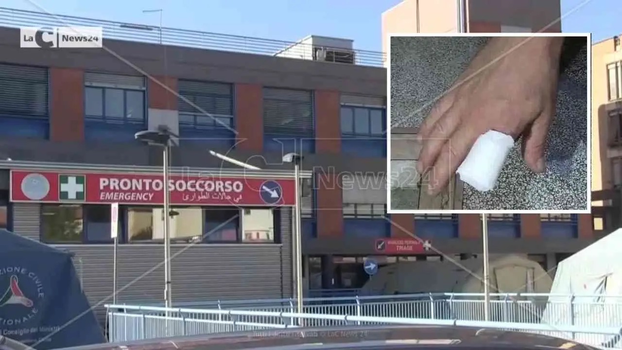 «Riattaccatemi il dito, presto»: ma in ospedale a Cosenza passa più di un’ora e l’indice va in necrosi