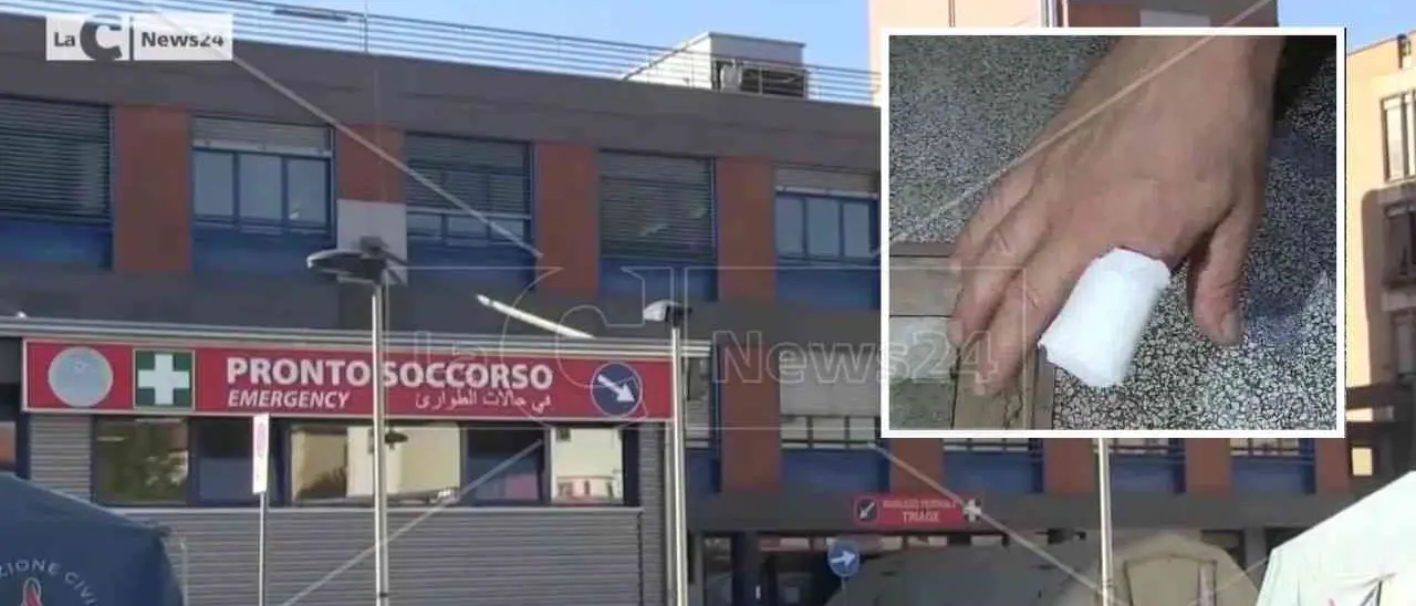 «Riattaccatemi il dito, presto»: ma in ospedale a Cosenza passa più di un’ora e l’indice va in necrosi