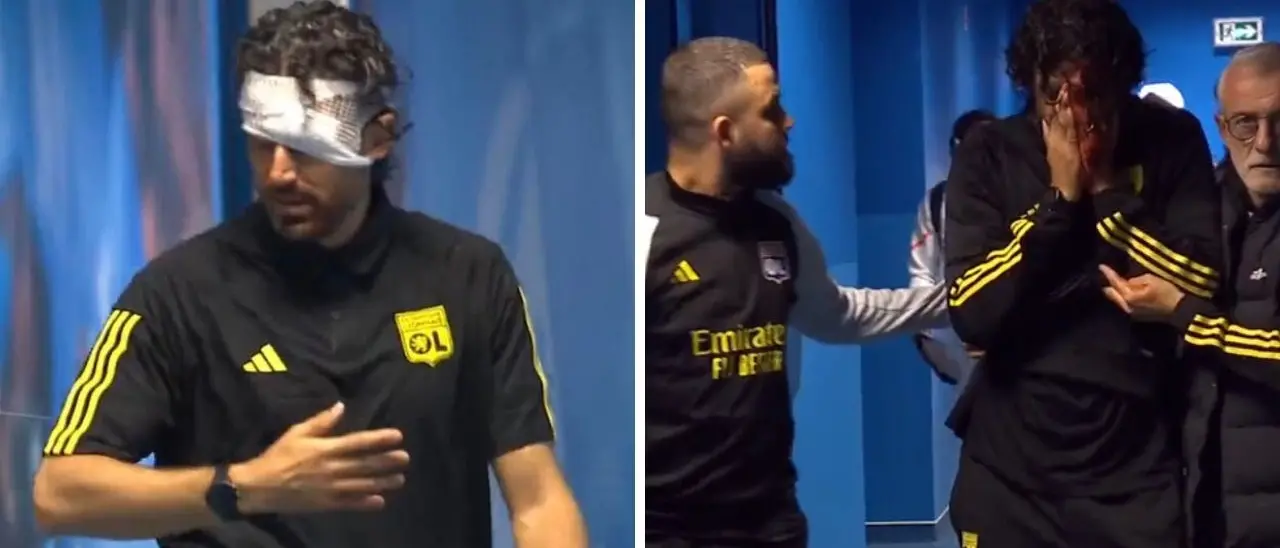 Follia a Marsiglia, Grosso ferito in un assalto al bus del Lione: 9 arresti