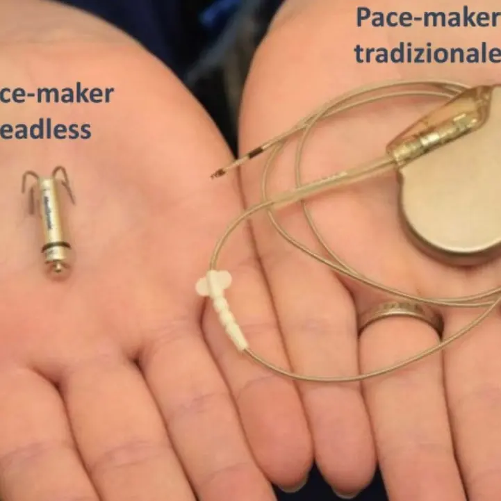Cardiologia, a Crotone impiantati con successo pacemaker senza fili