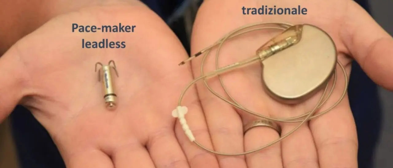 Cardiologia, a Crotone impiantati con successo pacemaker senza fili