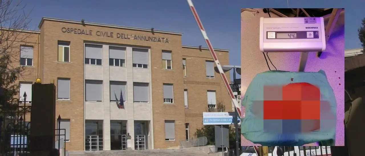 Cosenza, asportato un tumore all’addome di 4 chili e mezzo: intervento record all’Annunziata