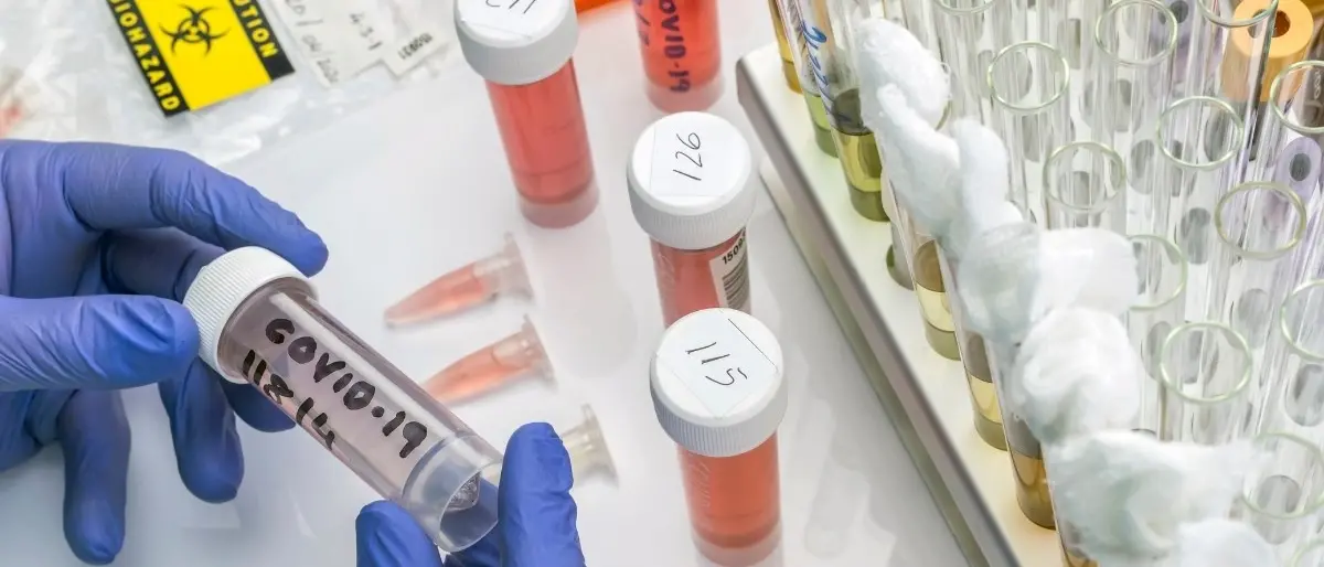 Covid Calabria, calano i contagi ma tanti decessi nel bollettino: 15 morti e 1256 nuovi casi