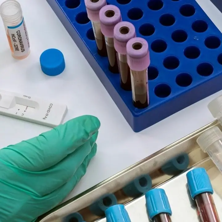 Covid Calabria, risalgono i contagi e i ricoveri in terapia intensiva: 1856 nuovi positivi e 11 decessi