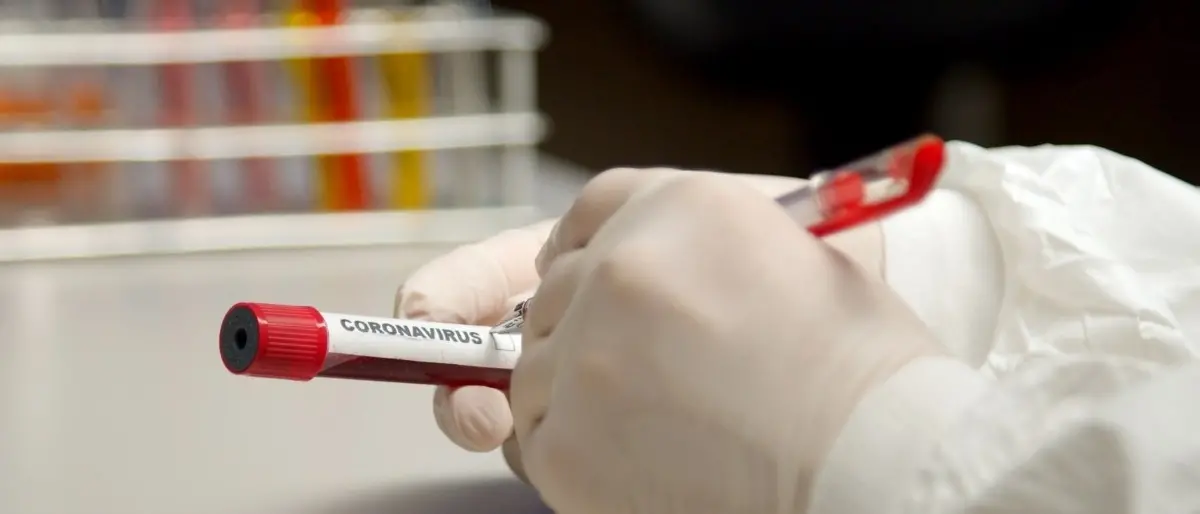 Covid, in Calabria calano i casi ma ci sono ancora tanti morti: 1656 nuovi positivi e 11 decessi