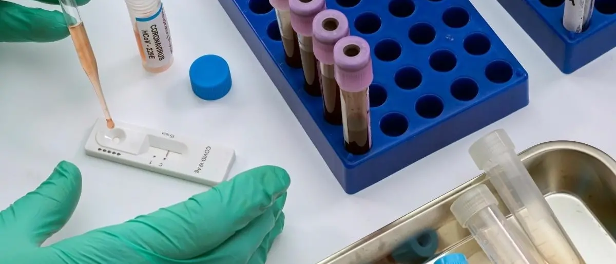 Covid, in Calabria calano i contagi ma con meno tamponi: 2197 nuovi casi e tasso di positività al 24%