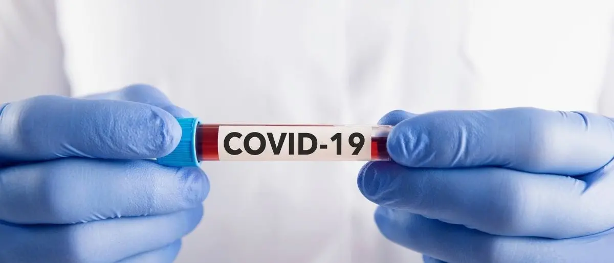 Covid, in Calabria il tasso di positività scende al 22.58%: 3.641 nuovi casi e 6 morti in 24 ore