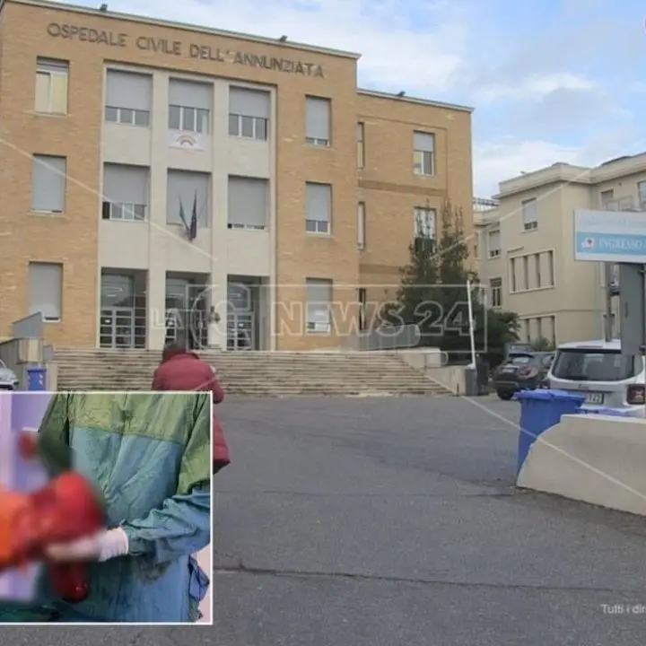 Intervento record in Calabria, asportato a Cosenza un tumore di 7,5 chili a una donna