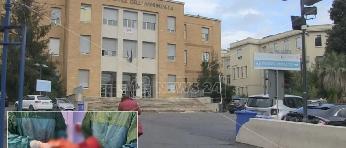 Intervento record in Calabria, asportato a Cosenza un tumore di 7,5 chili a una donna