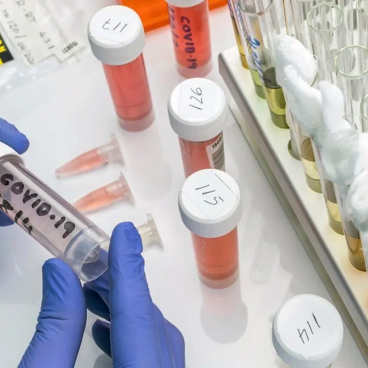 Covid, in Calabria scendono contagi e tasso di positività: 691 nuovi casi e 4 morti in 24 ore