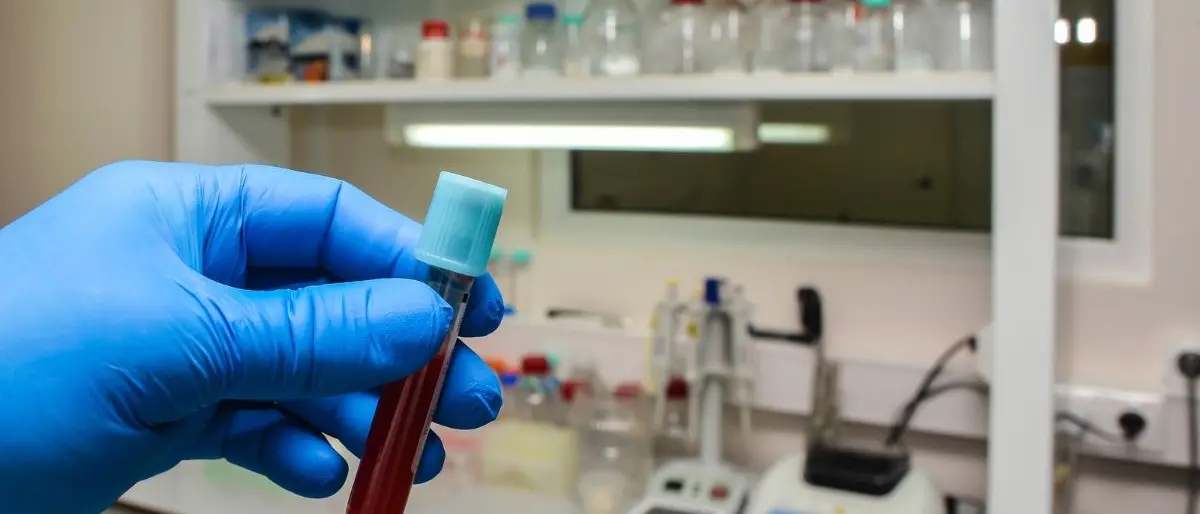 Guarisce dal cancro grazie a un nuovo farmaco costosissimo somministrato all’ospedale di Cosenza