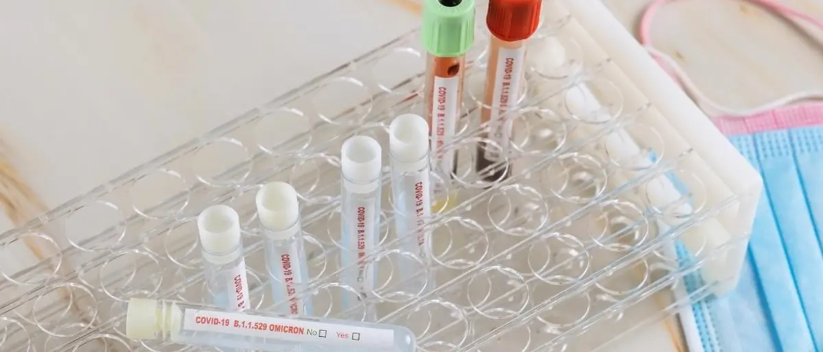 Covid, in Calabria tante guarigioni ma ancora 6 morti: nel bollettino 1.852 nuovi contagi