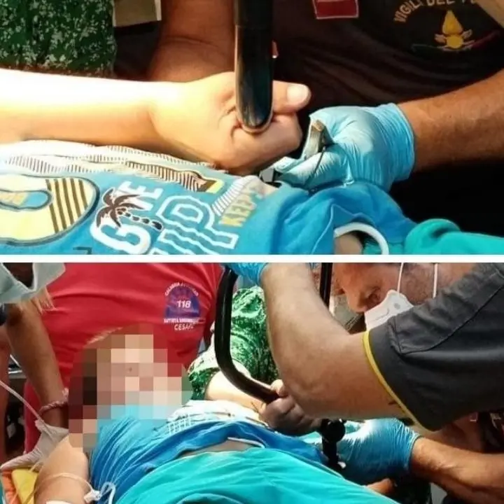 Cade dalla bici e s’infilza la pancia con il manubrio: bambino salvato all’ospedale di Crotone