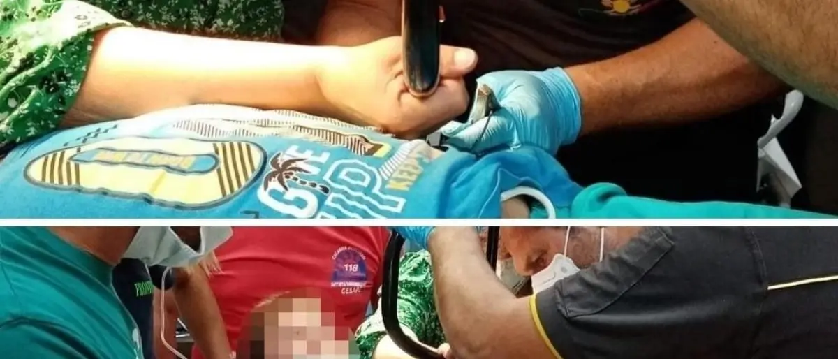 Cade dalla bici e s’infilza la pancia con il manubrio: bambino salvato all’ospedale di Crotone