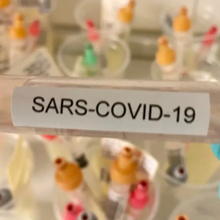 Covid, a Belvedere chiuso un centro di fisioterapia: riscontrati due contagi