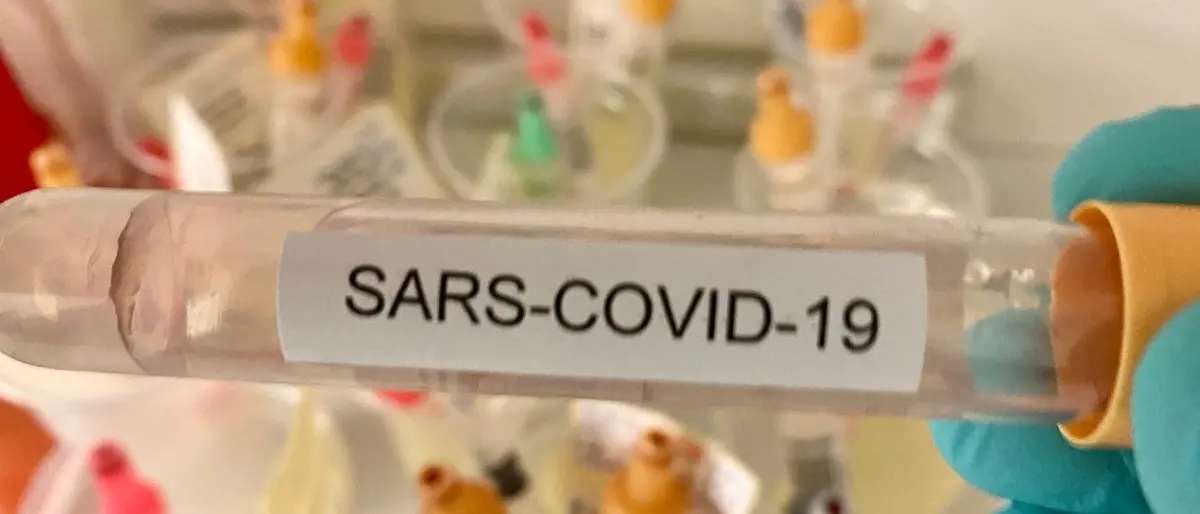 Covid, a Belvedere chiuso un centro di fisioterapia: riscontrati due contagi