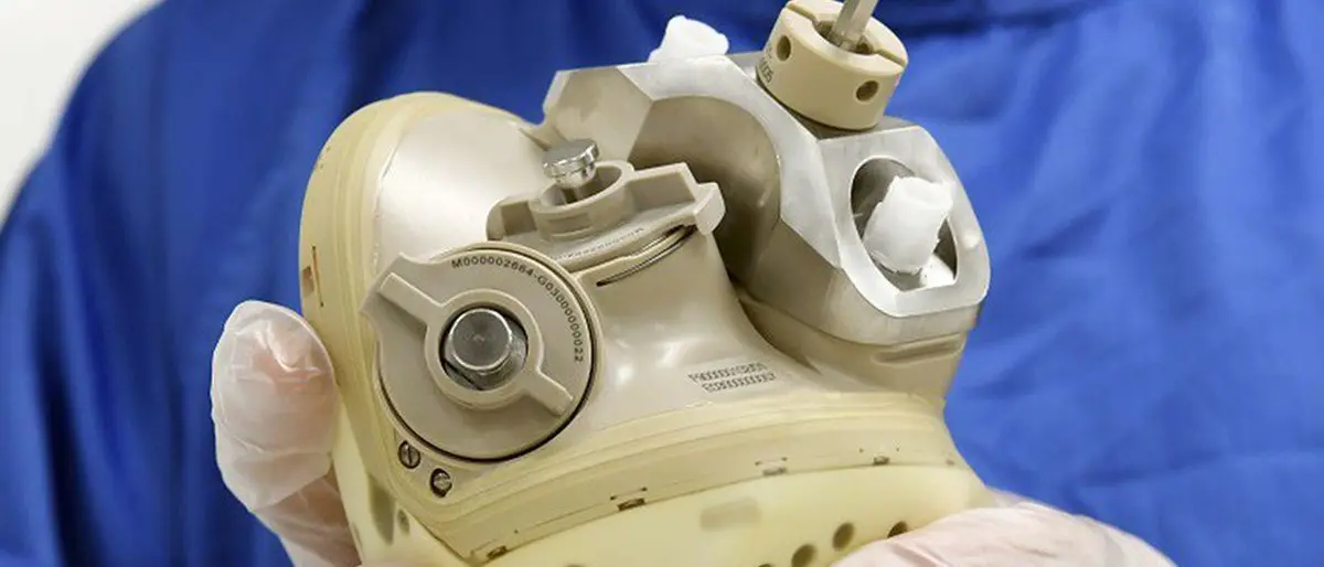 Napoli, impiantato il primo cuore bioartificiale totale a un paziente non candidabile al trapianto