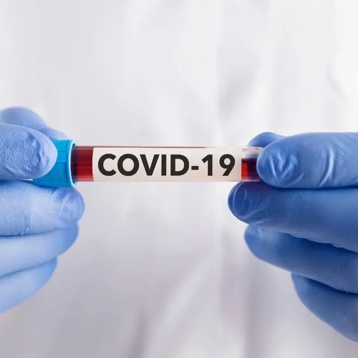 Covid: in Calabria 151 contagi, 3 decessi e 241 guariti nel bollettino regionale