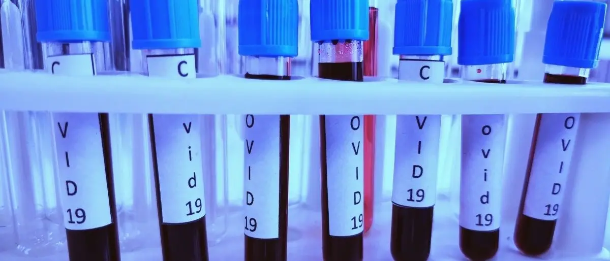 Covid, contagi in aumento negli over 40 mentre rallentano nella fascia 10-29 anni