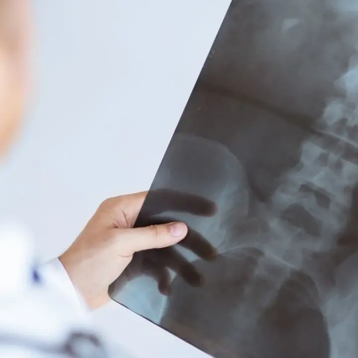 Tecnico in ferie e la radiologia alla casa della salute di Chiaravalle chiude, sindaci sul piede di guerra: «Pronti alla protesta»