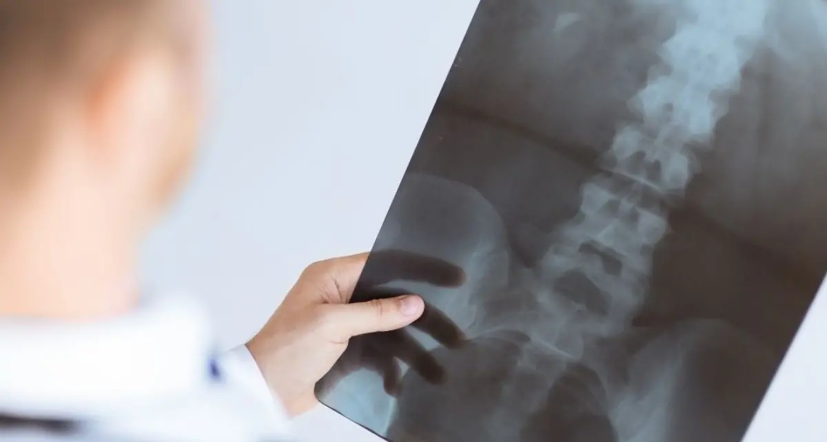 Tecnico in ferie e la radiologia alla casa della salute di Chiaravalle chiude, sindaci sul piede di guerra: «Pronti alla protesta»
