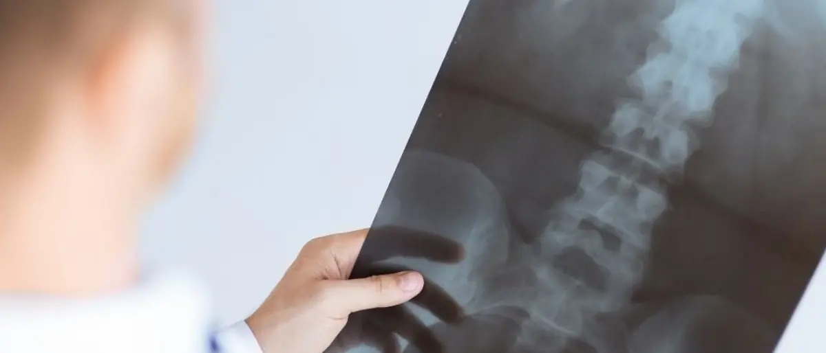 Il medico va in ferie per un mese e a Sersale niente radiografie in piena estate