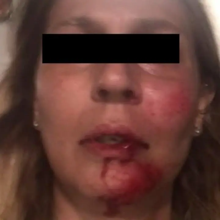 Tortora, il racconto della ricercatrice picchiata a sangue: «Volevano aggredire anche mia madre»