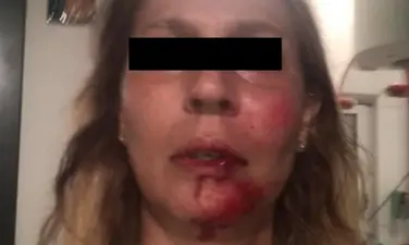 Tortora, il racconto della ricercatrice picchiata a sangue: «Volevano aggredire anche mia madre»