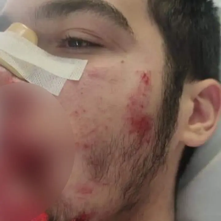 Ragazzo preso a pugni in faccia all’uscita da scuola a Castrolibero, il sindaco: «Arginare questi fenomeni»