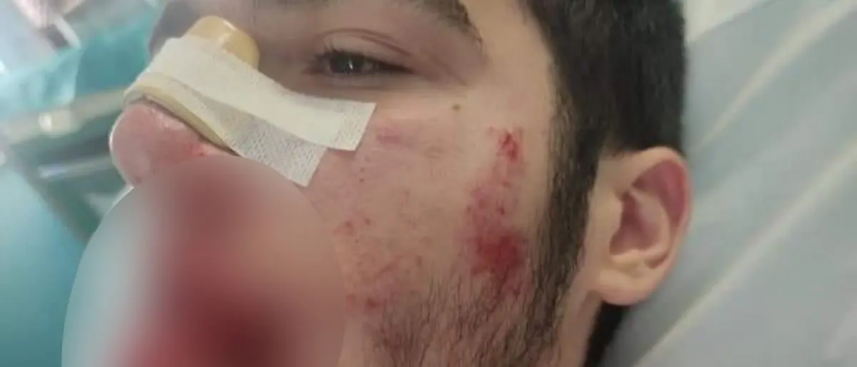 Castrolibero, l’aggressore del 14enne confessa ai genitori. Il papà: «Dovrà prendersi le sue responsabilità»