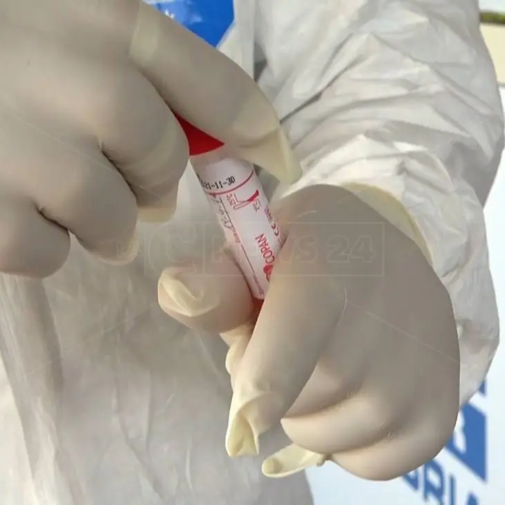 Covid, identificato a Varese il primo caso di variante brasiliana in Italia