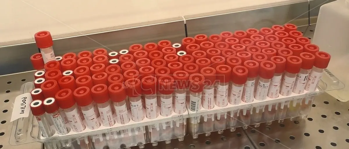 Coronavirus, 49 nuovi contagi tra Vibo Valentia e Catanzaro