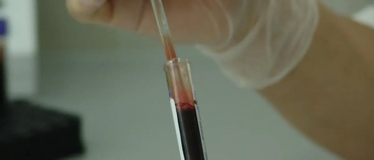 Covid, la Calabria in campo per la raccolta plasma: 535mila euro di fondi