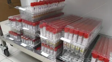 Corigliano-Rossano, macchinario ancora guasto: disagi per gli esami sui tamponi