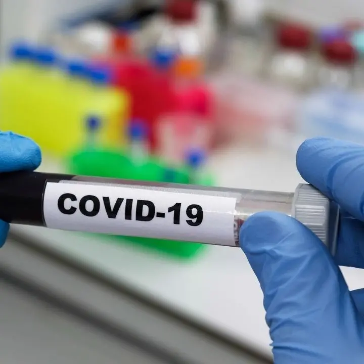 Covid Calabria, ancora tanti morti: 9 decessi e 168 nuovi positivi ma con pochi tamponi