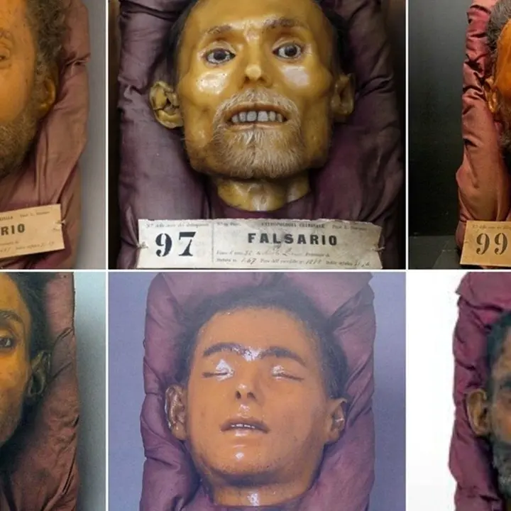 Il razzismo antimeridionale in mostra nel museo di Lombroso: «Basta, va chiuso»