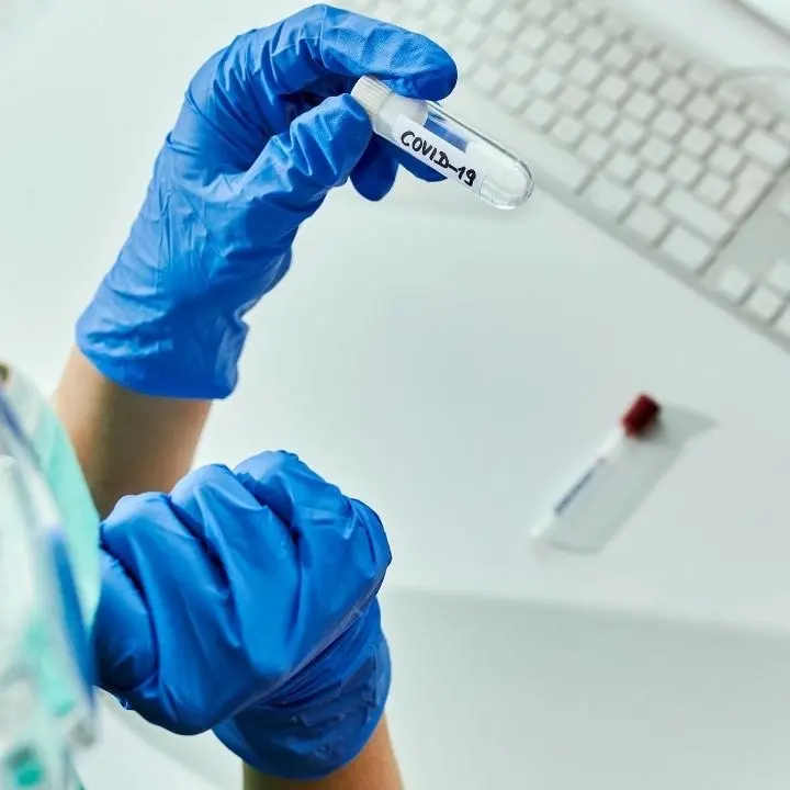 Covid, in Italia discesa dei contagi in frenata: meno test nelle ultime quattro settimane