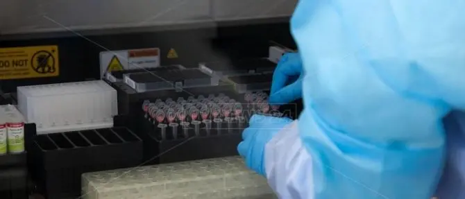 Coronavirus, in provincia di Catanzaro registrato un nuovo contagio