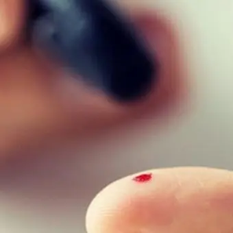 Coronavirus, al via i test sierologici: coinvolte 150mila persone in tutta Italia