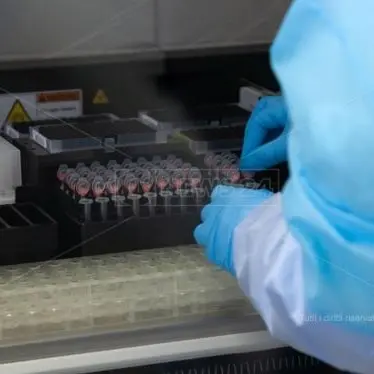 Coronavirus a Reggio Calabria, nessun nuovo contagio: il bollettino del Gom
