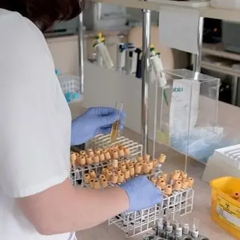 Coronavirus, studio italiano individua i geni che aumentano il rischio contagio