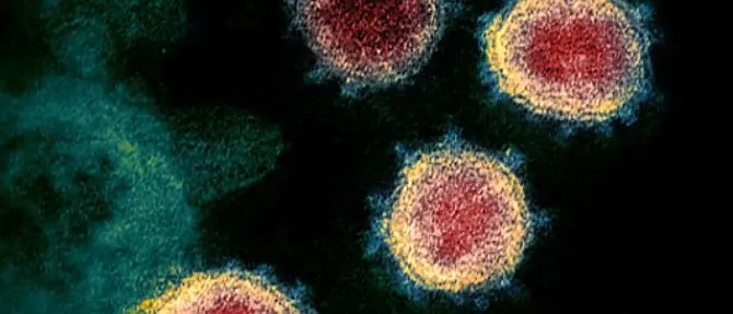 Coronavirus, Locatelli (Css): «Seconda ondata possibile. Ma non sarà forte come la prima»