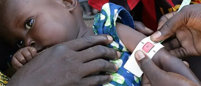 Effetto Covid, l'allarme Unicef: «Altri 7 milioni di bambini rischiano la malnutrizione»