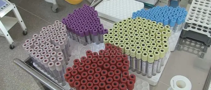 Conversione laboratori nel Cosentino, Guccione: «Riforma sanitaria incompleta»