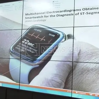 Riconoscere un attacco cardiaco dallo smartwatch, la sperimentazione a Catanzaro