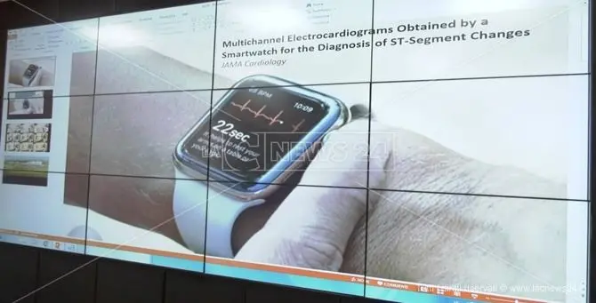 Riconoscere un attacco cardiaco dallo smartwatch, la sperimentazione a Catanzaro