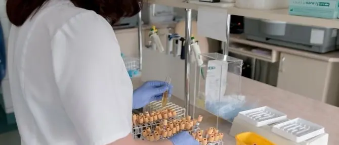 Fuga di batteri da laboratorio in Cina: oltre 3mila persone si ammalano di brucellosi